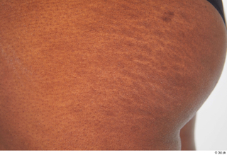 Dina Moses skin stretch marks 0001.jpg